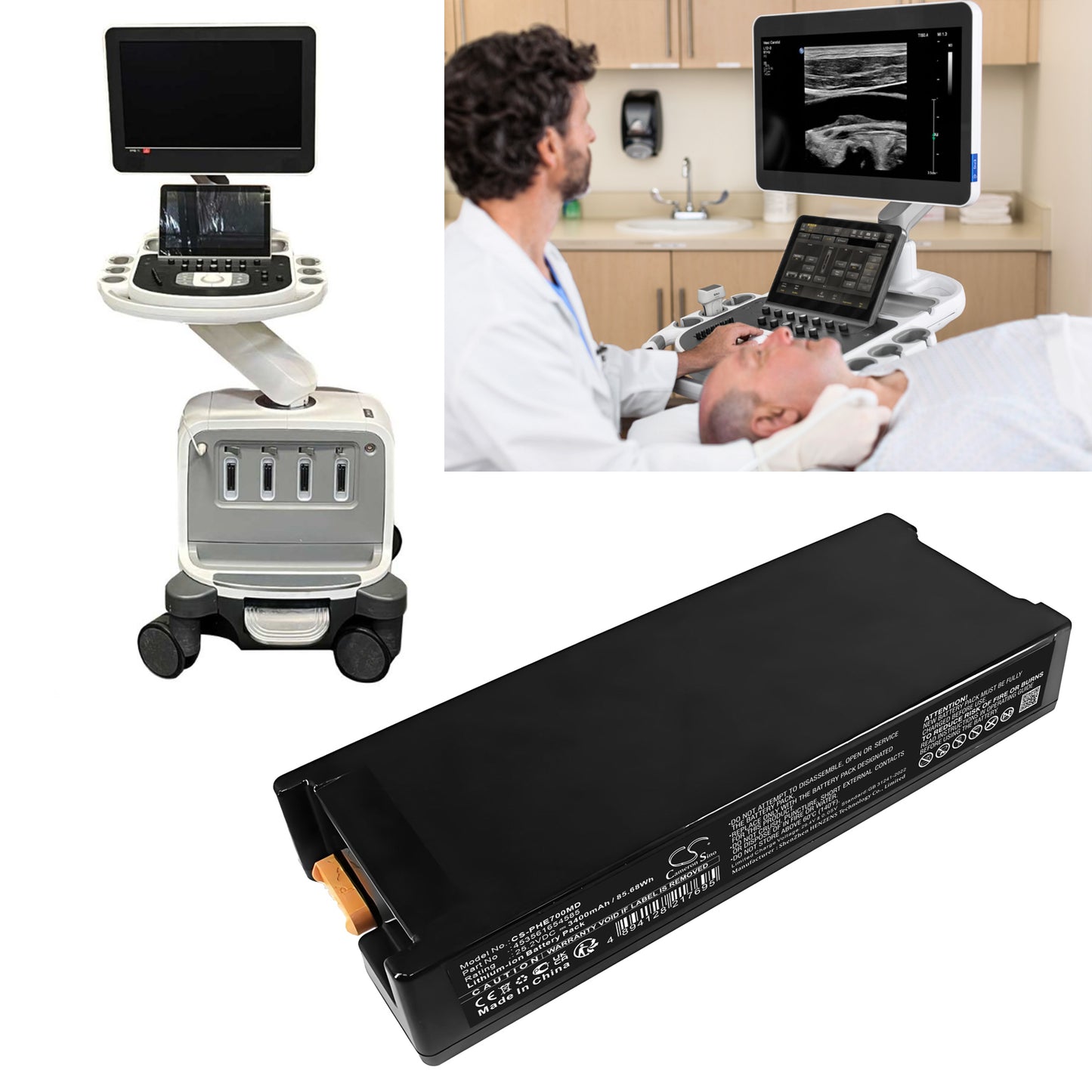 3400mAh 453561654585, 453561840572A, 453561904974, 453561990901 Battery for Philips Epiq 7C ultrasound system